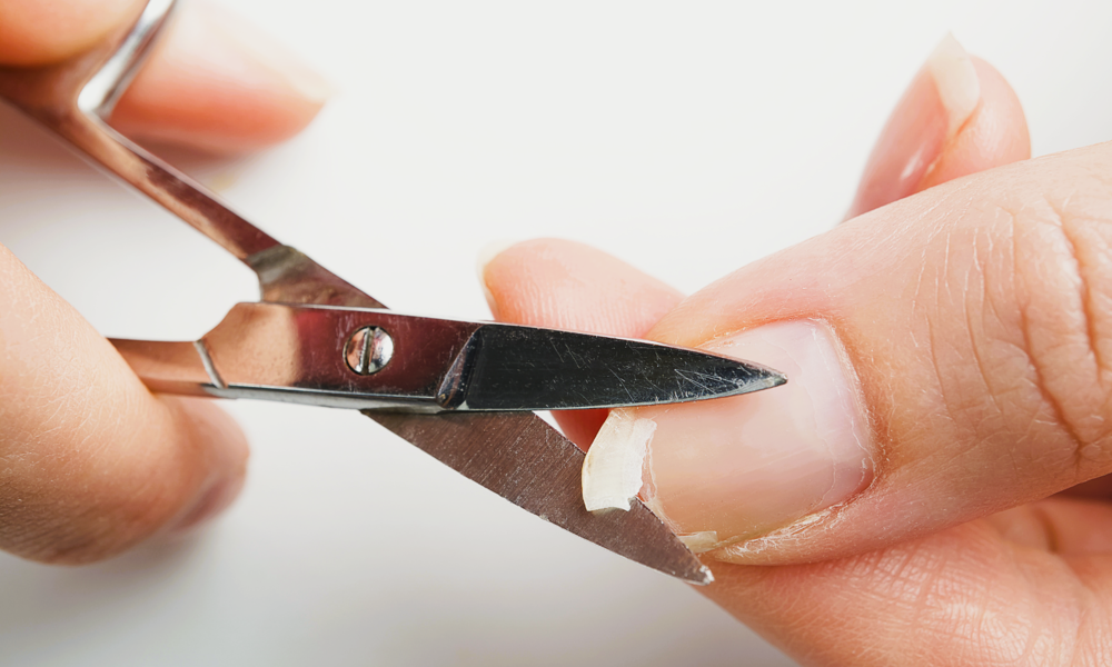 Eingerissene Fingernägel | © Adobe Stock/Ilja