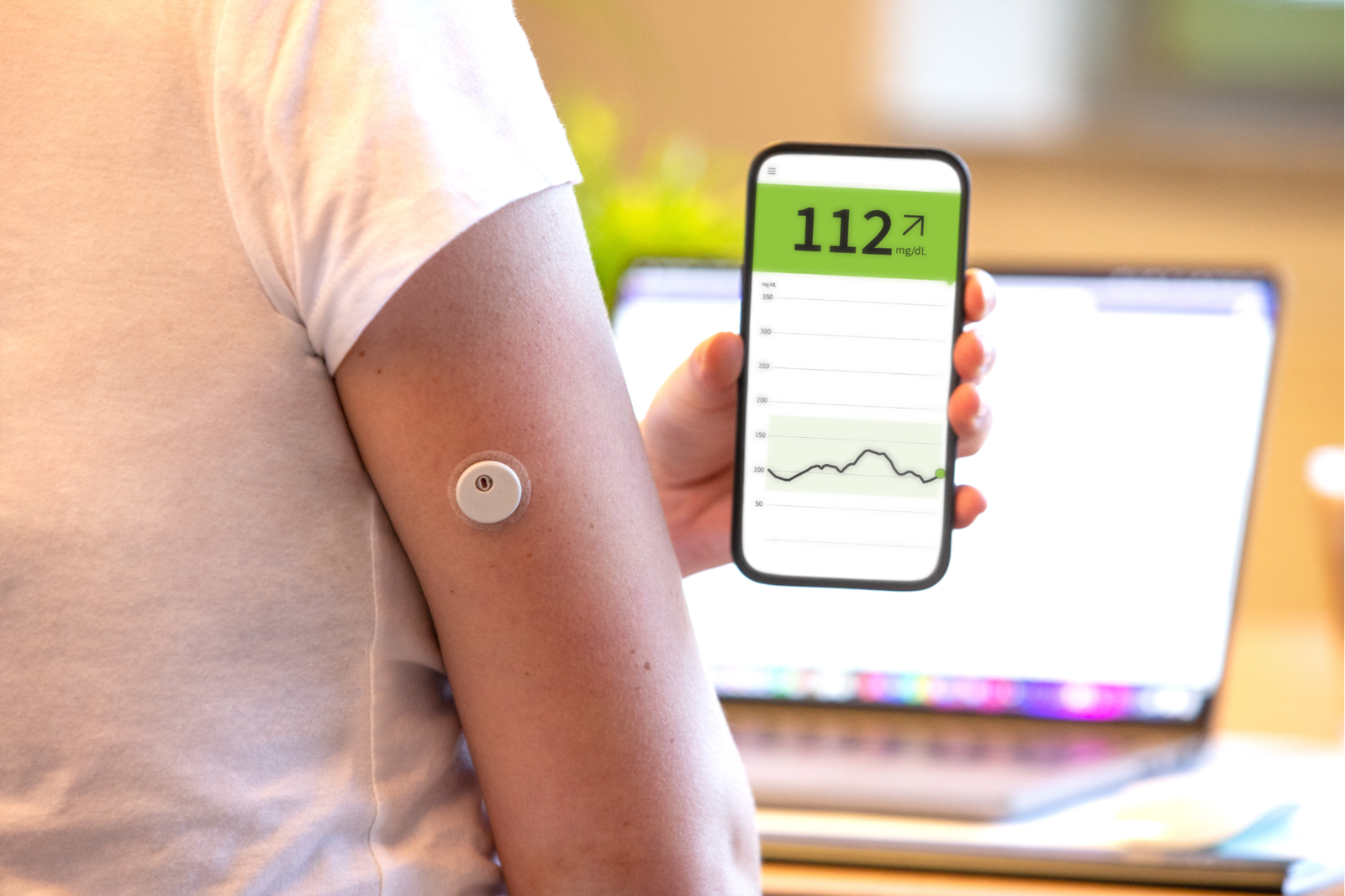 Person mit weißem T-Shirt trägt einen Glukosesensor am Oberarm und liest den Blutzuckerspiegel auf einem Smartphone ab. | © Rothenburg & Partner